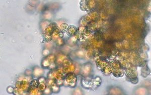 Mikroskopisches Bild von Trentepohlia umbrina aus dem gelborangen Belag des Schaukelpfostens
